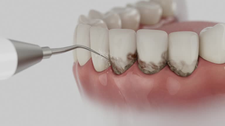 Reliable Dental contractor in Yellow Springs, OH by Dentist Open Now